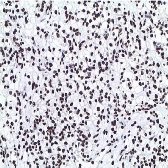 ERCC1 Monoclonal Antibody (Clone SP68)