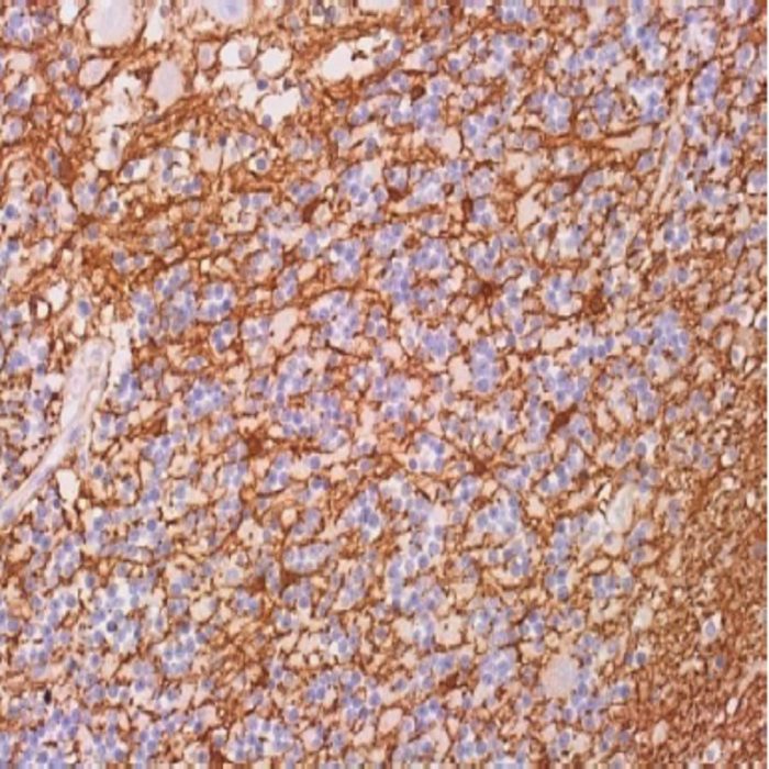 GFAP (Glial Fibrillary Acidic Protein) Polyclonal Antibody