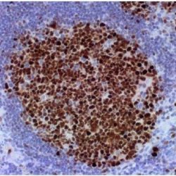 Mouse anti-human BCL-6 Monoclonal Antibody