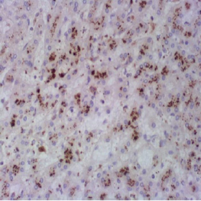 Mouse monoclonal to Hepatitis C Virus NS3 (Clone MMM33)