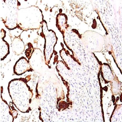 Placental Lactogen (hPL) Polyclonal Antibody