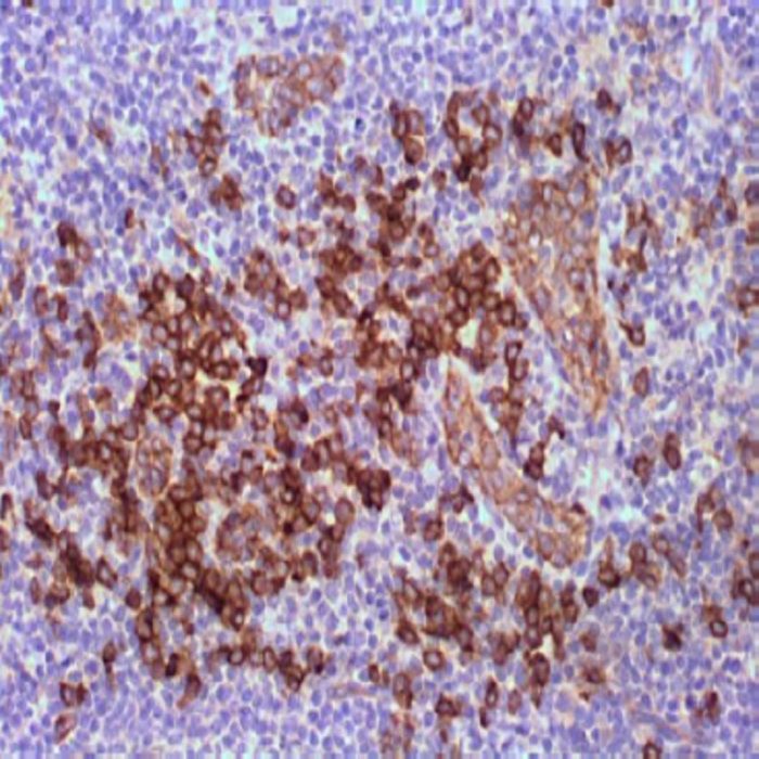 CD123 (Interleukin-3 Receptor Alpha Chain) Monoclonal Antibody