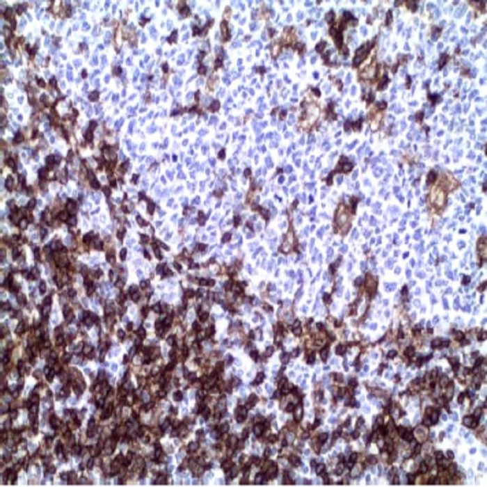 CD4 Monoclonal Antibody