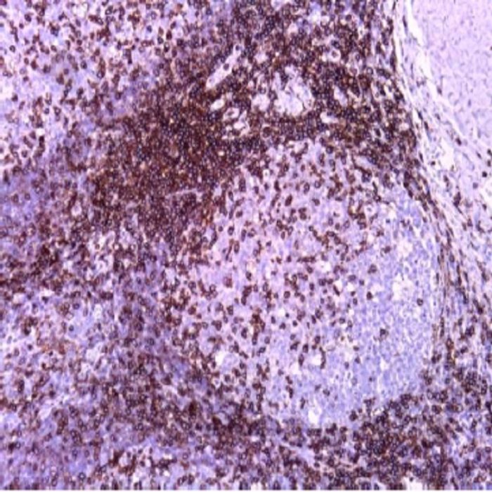 CD43 Monoclonal Antibody