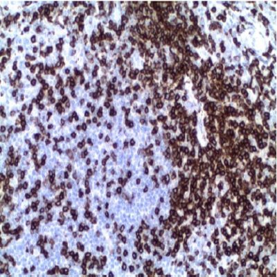CD7 Monoclonal Antibody