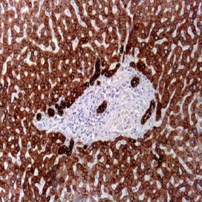 Keratin 18 Monoclonal Antibody