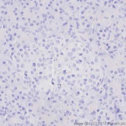 Rabbit Anti-Human PRAME 1 Monoclonal Antibody (Clone EPR20330)