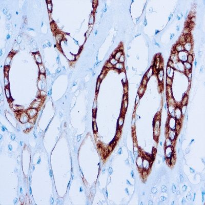 Mouse anti- Human Renal cell carcinoma marker (PN-15) Monoclonal Antibody