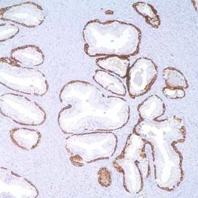 آنتی بادی Cytokeratin کلون 34BE12 برند Patho Sage