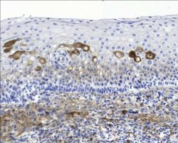 آنتی بادی Kappa Immunoglobulin Light Chain کلون L1C1 برند Patho Sage