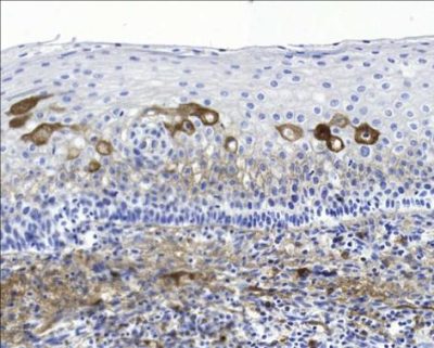 آنتی بادی Kappa Immunoglobulin Light Chain کلون L1C1 برند Patho Sage