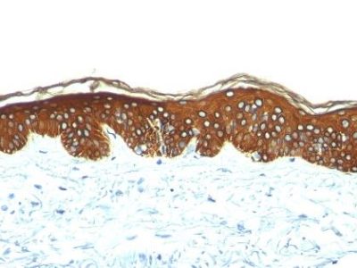 آنتی بادی Cytokeratin کلون AE1 برند Patho Sage