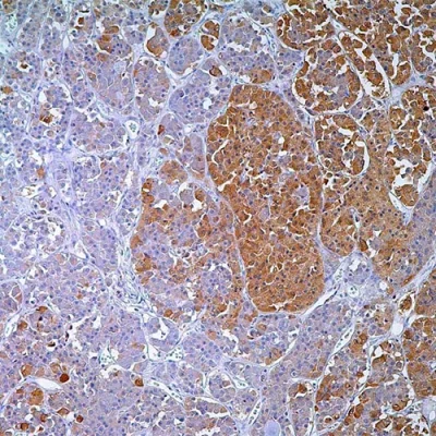 آنتی بادی ACTH(Adrenocorticotropic Hormone) کلون Polyclonal برند PathoSage