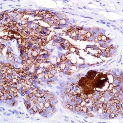 آنتی بادی Adipophilin کلون Polyclonal برند PathoSage
