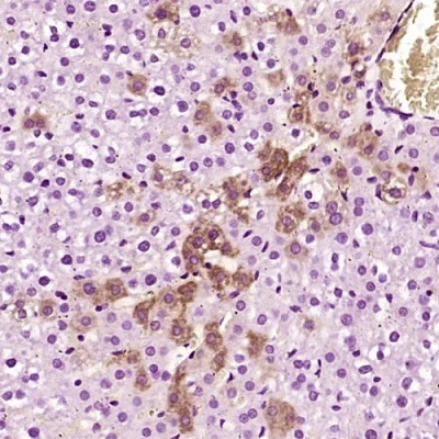 آنتی بادی Alpha1 Antichymotrypsin کلون Polyclonal برند PathoSage