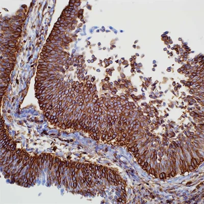 آنتی بادی CD44 کلون SP37 برند PathoSage