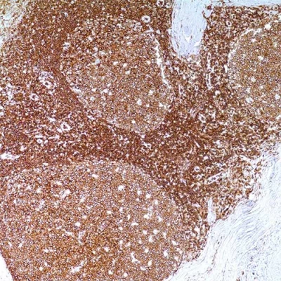 آنتی بادی CD45 کلون 2B11&PD7/26 برند PathoSage