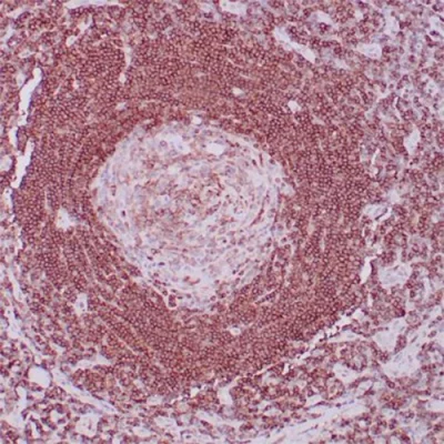 آنتی بادی CD45RA کلون SPM504 برند PathoSage
