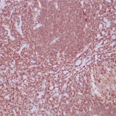 آنتی بادی CD45RB کلون BRA-11 برند PathoSage