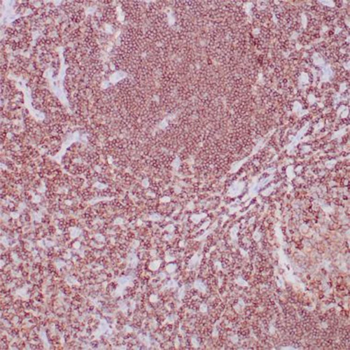 آنتی بادی CD45RB کلون BRA-11 برند PathoSage