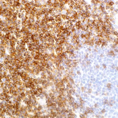آنتی بادی CD5 کلون EP77 برند PathoSage