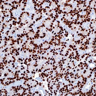 آنتی بادی AR(Androgen Receptor) کلون SP107 برند PathoSage