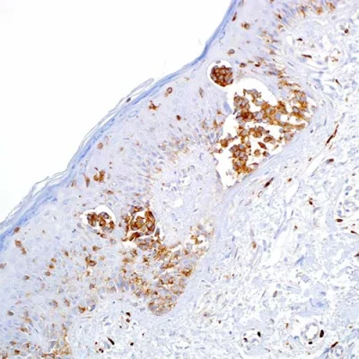 آنتی بادی CD63 کلون NKI/C3 برند PathoSage
