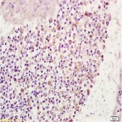 آنتی بادی CD64 کلون EPR4624 برند PathoSage