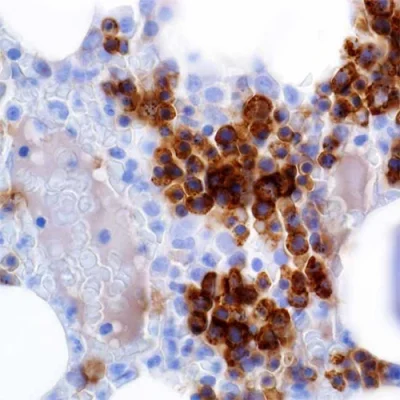 آنتی بادی CD71 کلون 10F11 برند PathoSage