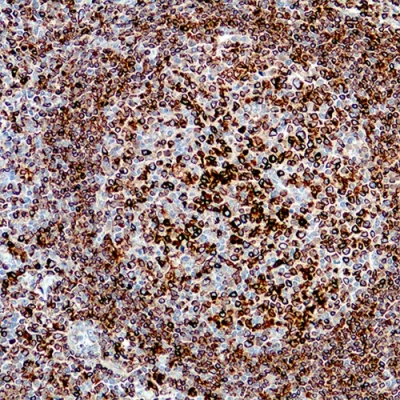 آنتی بادی CD74 کلون LN-2 برند PathoSage