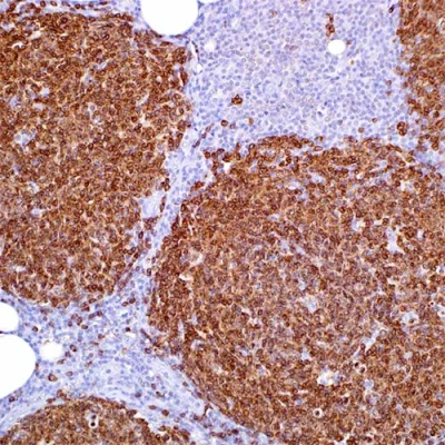 آنتی بادی CD79a(MB-1) کلون SP18 برند PathoSage