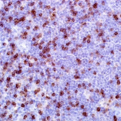 آنتی بادی CD8 کلون SP16 برند PathoSage