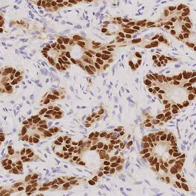 آنتی بادی CDX2 کلون EP25 برند PathoSage