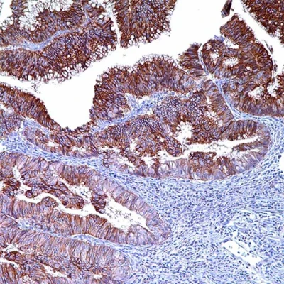 آنتی بادی Claudin 1 کلون Polyclonal برند PathoSage