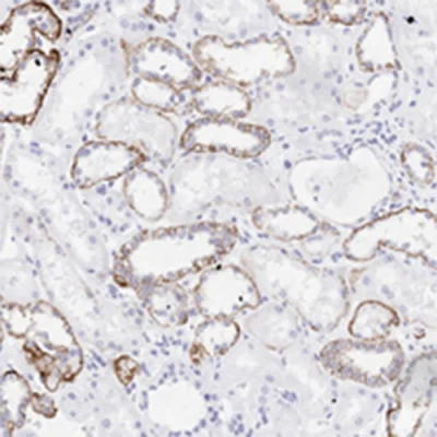 آنتی بادی Claudin 7 کلون Polyclonal برند PathoSage