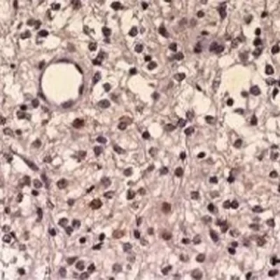 آنتی بادی C-Myc کلون Y69 برند PathoSage