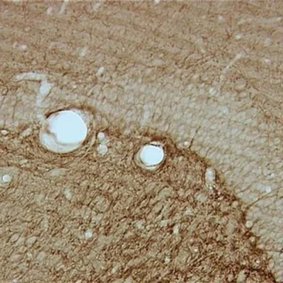 آنتی بادی CNPasa کلون 11-5B برند PathoSage