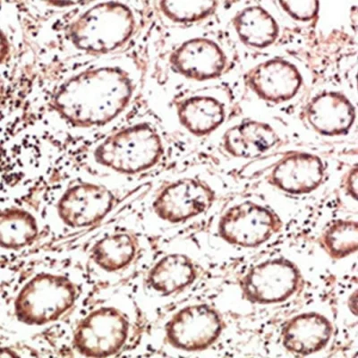 آنتی بادی Collagen 2 کلون 2B1.5 برند PathoSage