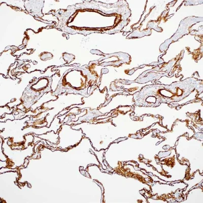 آنتی بادی Collagen 4 کلون CIV22 برند PathoSage