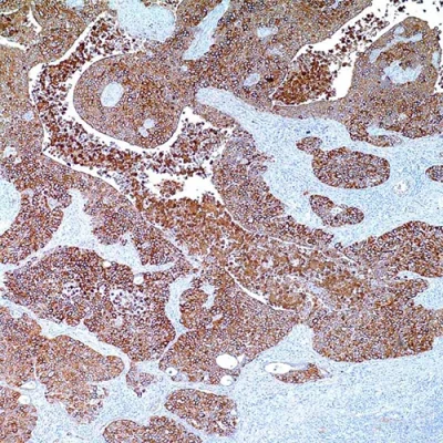 آنتی بادی Cytokeratin کلون AE3 برند PathoSage