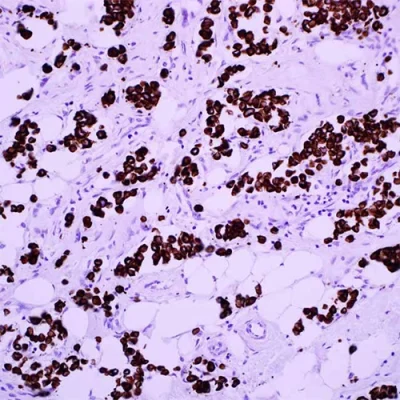 آنتی بادی Cytokeratin کلون CAM 5.2 برند PathoSage