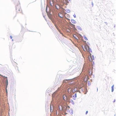 آنتی بادی Cytokeratin 10 کلون SP99 برند PathoSage