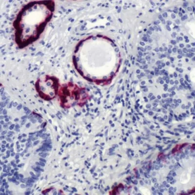آنتی بادی Cytokeratin 5 کلون SP27 برند PathoSage