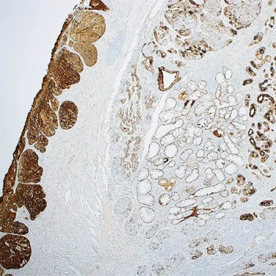 آنتی بادی Cytokeratin 5/6 کلون EP24/EP67 برند PathoSage