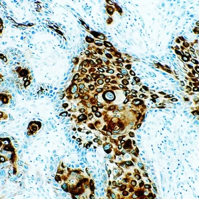 آنتی بادی Cytokeratin 5/6/8/18 کلون EP24/EP67/B22.1&B23.1 برند PathoSage