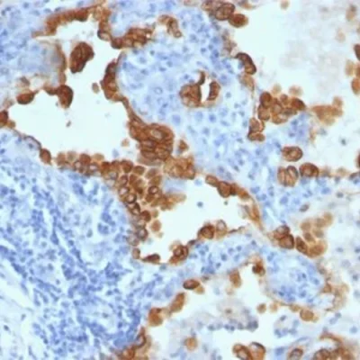 آنتی بادی Cytokeratin 8/18/19 کلون B22.1&B23.1/BA17 برند PathoSage