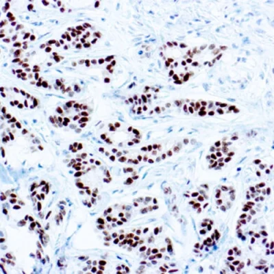 آنتی بادی ER(Estrogen Receptor) کلون SP1 برند PathoSage