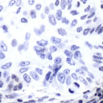 آنتی بادی ERCC1 کلون SP68 برند PathoSage