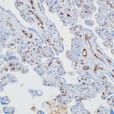 آنتی بادی Factor 8 کلون Polyclonal برند PathoSage