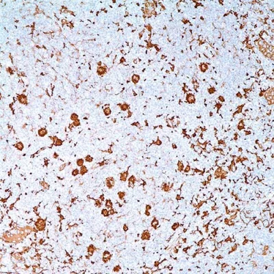 آنتی بادی Fascin کلون FCN01 برند PathoSage